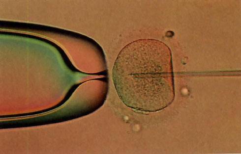 深圳双胞胎试管婴儿包成功:关于良好精子的自我培养