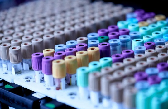 什么是香港Y-DNA测试？血液测试的条件，以确定男性和女性。