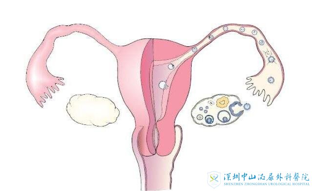 我的卵巢没有任何异常，我的输卵管也很通畅。如果我现在尝试试管婴儿，会有一个好的怀孕吗？