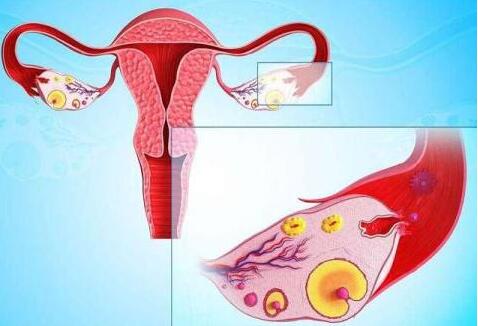 卵巢早衰可以自然怀孕并考虑做试管婴儿吗？