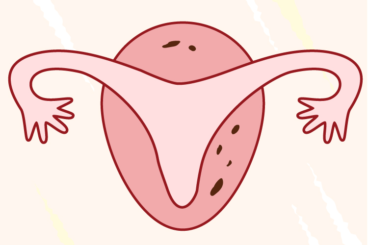 泰州les供卵助孕-泰国试管婴儿胚胎受精的提示